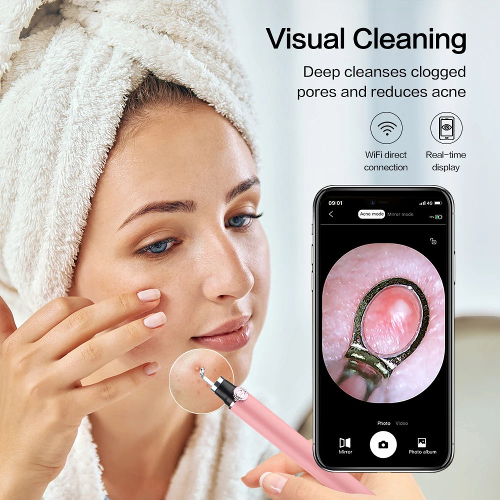 Visible Blackhead Remover