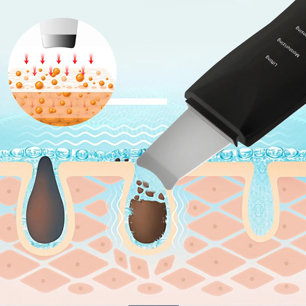 Ultrasonic Facial Scrubber